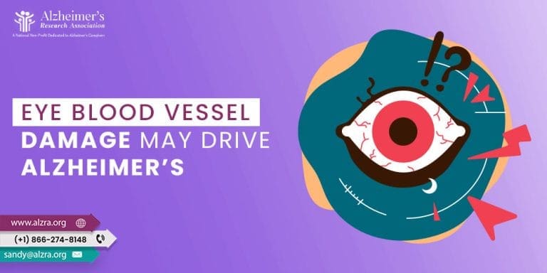 Eye Blood Vessel Damage May Drive Alzheimer’s